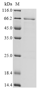 Human Interleukin-26 (IL26),Biotinylated Recombinant Protein, Homo sapiens (Human), E.coli, N-terminal MBP-tagged and C-terminal 6xHis-Avi-tagged, 65.3 kDa, purity >≥ 85% as determined by SDS-PAGE.