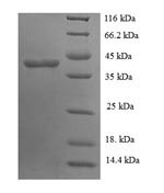 Human Glycosyltransferase 8 domain-containing protein 2 (GLT8D2) Recombinant Protein - BioCrest Sci