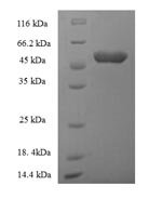 Human Acyl-CoA-binding domain-containing protein 4 (ACBD4) Recombinant Protein, Homo sapiens (Human), E.coli, N-terminal 6xHis-SUMO-tagged, 50.8 kDa, purity >≥ 90% as determined by SDS-PAGE.