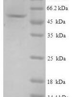 Human GMP reductase 1 (GMPR) Recombinant Protein - BioCrest Sci