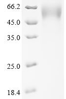 Severe acute respiratory syndrome coronavirus 2 Spike glycoprotein (S) (G75V,T76I,SYLTPGD247-253del), partial Recombinant Protein - BioCrest Sci