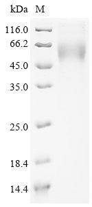 Severe acute respiratory syndrome coronavirus 2 Spike glycoprotein (S) (G75V,T76I,SYLTPGD247-253del), partial Recombinant Protein, Severe acute respiratory syndrome coronavirus 2 (2019-nCoV) (SARS-CoV-2), Mammalian cell, N-terminal 10xHis-tagged, 37.4 kDa, purity >≥ 90% as determined by SDS-PAGE.