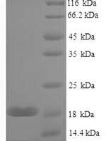 Mouse Galectin-7 (Lgals7) Recombinant Protein, N-His, aa 2–136, E.coli - BioCrest Sci
