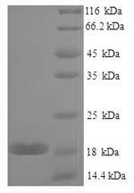 Mouse Galectin-7 (Lgals7) Recombinant Protein, N-His, aa 2–136, E.coli, Mus musculus (Mouse), E.coli, N-terminal 6xHis-tagged, 19.0 kDa, purity >≥ 90% as determined by SDS-PAGE.