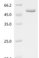 Escherichia coli DNA gyrase subunit B(gyrB), partial Recombinant Protein, C-His - BioCrest Sci