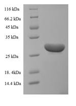 Human Neurotrophic factor BDNF precursor form (BDNF) Recombinant Protein, N-His-SUMO, Homo sapiens (Human), E.coli, N-terminal 6xHis-SUMO-tagged, 29.5 kDa, purity >≥ 90% as determined by SDS-PAGE.