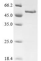 Human Melanoma-associated antigen 4 (MAGEA4) Recombinant Protein - BioCrest Sci