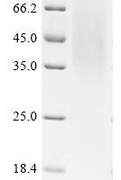 Simian retrovirus SRV-1 Envelope glycoprotein (env), partial Recombinant Protein - BioCrest Sci