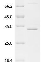 Conus radiatus Iota-conotoxin-like r11c Recombinant Protein, C-His-PDI - BioCrest Sci