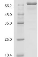 Human
Protein-arginine deiminase type-3 (PADI3) Recombinant Protein - BioCrest Sci