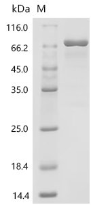 Human
Protein-arginine deiminase type-3 (PADI3) Recombinant Protein, Homo sapiens (Human), Mammalian cell, C-terminal 10xHis-tagged, 76.1 kDa, purity >≥ 85% as determined by SDS-PAGE.