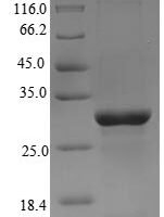Chicken Anosmin-1 (ANOS1), partial Recombinant Protein - BioCrest Sci