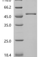 Human S-adenosylmethionine synthase isoform type-1 (MAT1A) Recombinant Protein, N-10His - BioCrest Sci