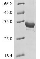 Human Microtubule-associated protein 1A (MAP1A), partial Recombinant Protein - BioCrest Sci