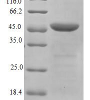 Human Heterogeneous nuclear ribonucleoproteins A2/B1 (HNRNPA2B1) Recombinant Protein, N-His-B2M - BioCrest Sci