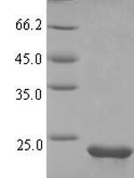 Rat Osteocrin (Ostn), partial Recombinant Protein - BioCrest Sci