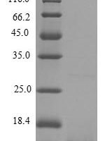Human Scrapie-responsive protein 1 (SCRG1) Recombinant Protein - BioCrest Sci