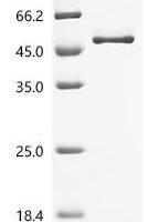 Human Complement factor H (CFH), partial Recombinant Protein, C-His - BioCrest Sci