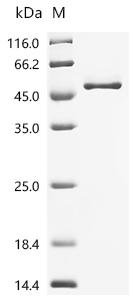 Human Complement factor H (CFH), partial Recombinant Protein, C-His, Homo sapiens (Human), Mammalian cell, C-terminal 6xHis-tagged, 50.7 kDa, purity >≥ 95% as determined by SDS-PAGE.