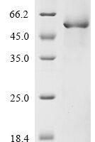 Human Netrin-4 (NTN4), partial Recombinant Protein, N-10His-GST/C-Myc - BioCrest Sci