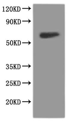 Rat Glutamate receptor ionotropic, NMDA 1 (Grin1), partial-VLPs, Fluorescent Recombinant Protein, Rattus norvegicus (Rat), Mammalian cell, C-terminal EGFP-tagged, 73.3 kDa, purity >The purity information is not available for VLPs proteins.