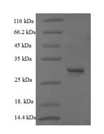 Bacillus thuringiensis subsp. kurstaki Pesticidal crystal protein Cry1Ab (cry1Ab), partial Recombinant Protein - BioCrest Sci