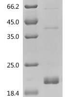 Mouse Transforming growth factor beta-1 proprotein (Tgfb1), partial Recombinant Protein, C-His - BioCrest Sci