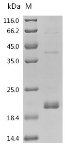 Mouse Transforming growth factor beta-1 proprotein (Tgfb1), partial Recombinant Protein, C-His, Mus musculus (Mouse), E.coli, C-terminal 6xHis-tagged, 19.7 kDa, purity >≥ 95% as determined by SDS-PAGE.