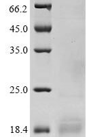 Rabbit Acrosin (ACR) Recombinant Protein - BioCrest Sci