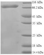 Human Harmonin (USH1C) Recombinant Protein - BioCrest Sci