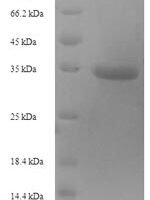 Mouse Metalloproteinase inhibitor 1 (Timp1) Recombinant Protein - BioCrest Sci