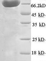 Mouse ATP synthase F(1) complex catalytic subunit beta, mitochondrial (Atp5f1b) Recombinant Protein, N-His-SUMO - BioCrest Sci