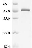 Human papillomavirus 11 Regulatory protein E2 (E2) Recombinant Protein, C-His - BioCrest Sci