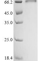 Human Gamma-butyrobetaine dioxygenase (BBOX1) Recombinant Protein - BioCrest Sci