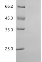 Human Ectonucleotide pyrophosphatase/phosphodiesterase family member 3 (ENPP3), partial Recombinant Protein - BioCrest Sci