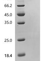 Mouse Protransforming growth factor alpha (Tgfa), partial Recombinant Protein, C-10His - BioCrest Sci
