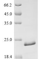 Human herpesvirus 6A Large structural phosphoprotein (U11), partial Recombinant Protein - BioCrest Sci
