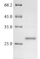 Mouse Placenta-expressed transcript 1 protein (Plet1) Recombinant Protein, N-10His - BioCrest Sci
