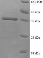 Human C-X-C motif chemokine 5 (CXCL5), partial Recombinant Protein - BioCrest Sci