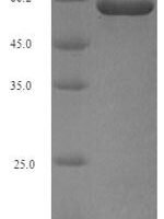 Porphyromonas gingivalis Peptidylarginine deiminase (PG_1424) Recombinant Protein - BioCrest Sci