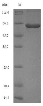 Porphyromonas gingivalis Peptidylarginine deiminase (PG_1424) Recombinant Protein, Porphyromonas gingivalis (strain ATCC BAA-308 / W83), E.coli, N-terminal 6xHis-tagged, 60.9 kDa, purity >≥ 90% as determined by SDS-PAGE.