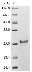 Human coronavirus OC43 Protein I (N) Recombinant Protein, Human coronavirus OC43 (HCoV-OC43), E.coli, C-terminal 6xHis-tagged, 25.2 kDa, purity >≥ 85% as determined by SDS-PAGE.