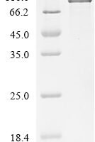 Mouse Osteopontin (Spp1), partial Recombinant Protein, C-hFc1 - BioCrest Sci