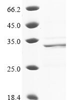 Cat Troponin I, cardiac muscle (TNNI3) Recombinant Protein - BioCrest Sci