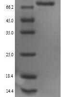 Rat Neuroendocrine convertase 1 (Pcsk1) Recombinant Protein - BioCrest Sci