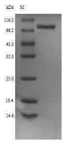 Rat Neuroendocrine convertase 1 (Pcsk1) Recombinant Protein, Rattus norvegicus (Rat), Yeast, N-terminal 6xHis-tagged, 73.2 kDa, purity >≥ 90% as determined by SDS-PAGE.
