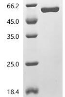 Human TATA-binding protein-associated factor 2N (TAF15), partial Recombinant Protein, C-His, aa 151–592 - BioCrest Sci