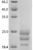 Human MHC class I chain-related molecule B (MICB), partial Recombinant Protein, C-10His, aa 204–297 - BioCrest Sci