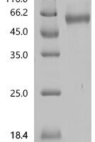 Human GTPase NRas (NRAS) Recombinant Protein, N-mFc - BioCrest Sci