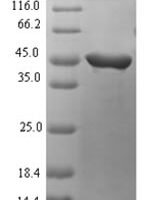 Streptococcus pyogenes serotype M28 Streptopain (speB) Recombinant Protein - BioCrest Sci